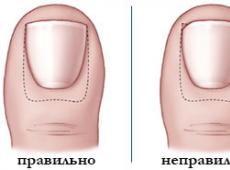 Как правильно стричь ногти на ногах: полезные советы Правильная стрижка ногтей